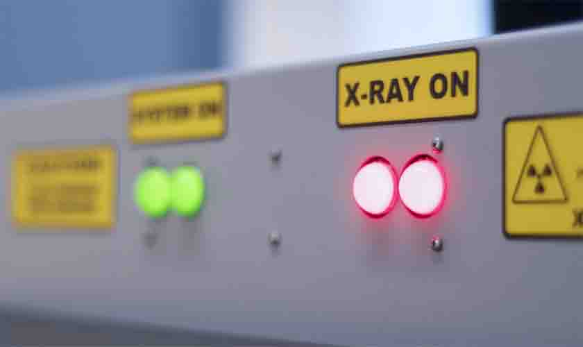 Operador de raio-X de segurança postal receberá adicional de periculosidade