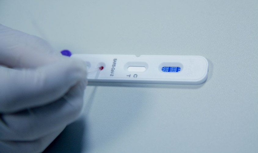 Governo de Rondônia inicia nesta quarta-feira, 3, testagem simultânea para Covid-19 em grande escala para população