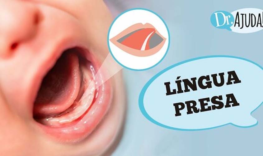 Língua presa: o que causa e como tratar?