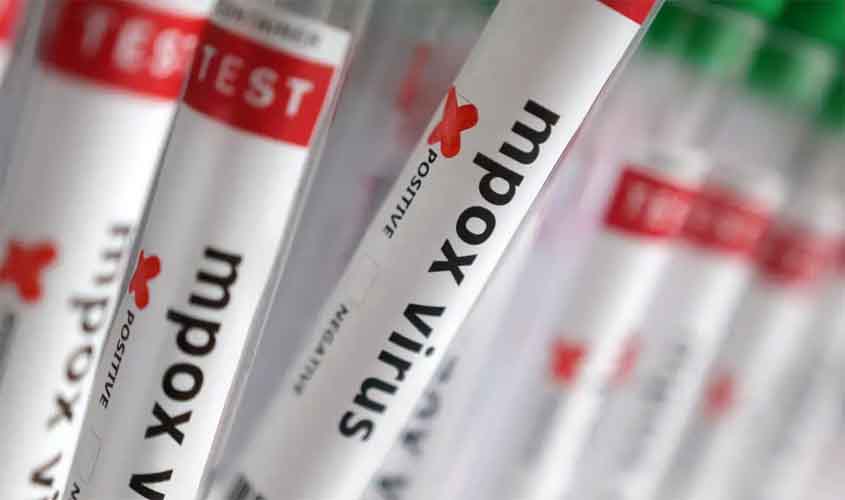 Região Norte do Brasil registra casos de mpox