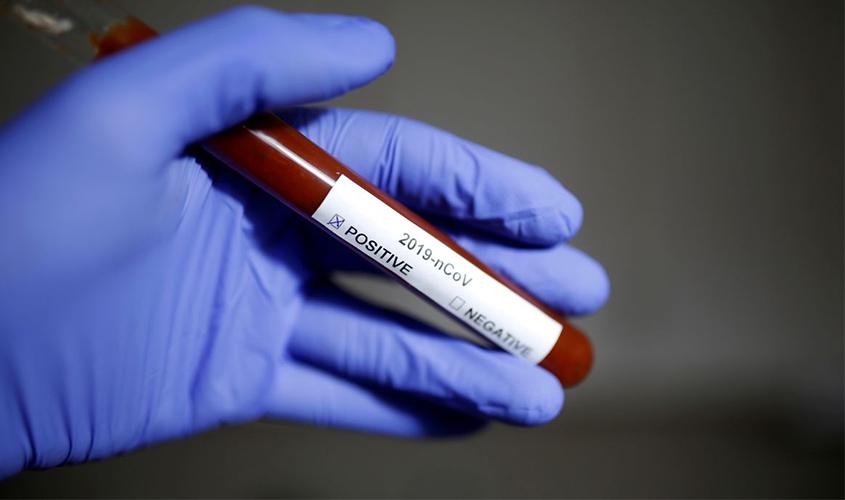 Brasil registra mais de 31 mil mortes por covid-19