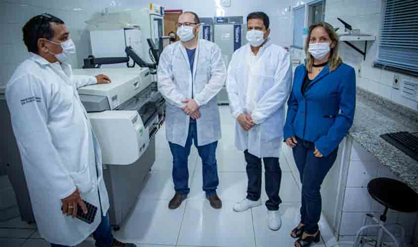 Em visita a Fhemeron, Jair Montes reforça importância de um hemocentro em Guajará-Mirim e destina emenda para reforma do prédio em Porto Velho