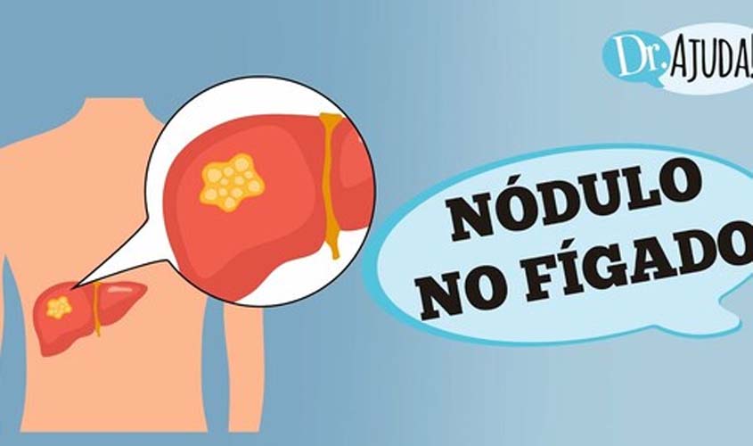 NÓDULO NO FÍGADO: Como diferenciar tumor benigno, maligno ou metastase