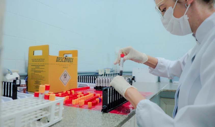 Prefeitura oferece exames laboratoriais em 17 unidades de saúde