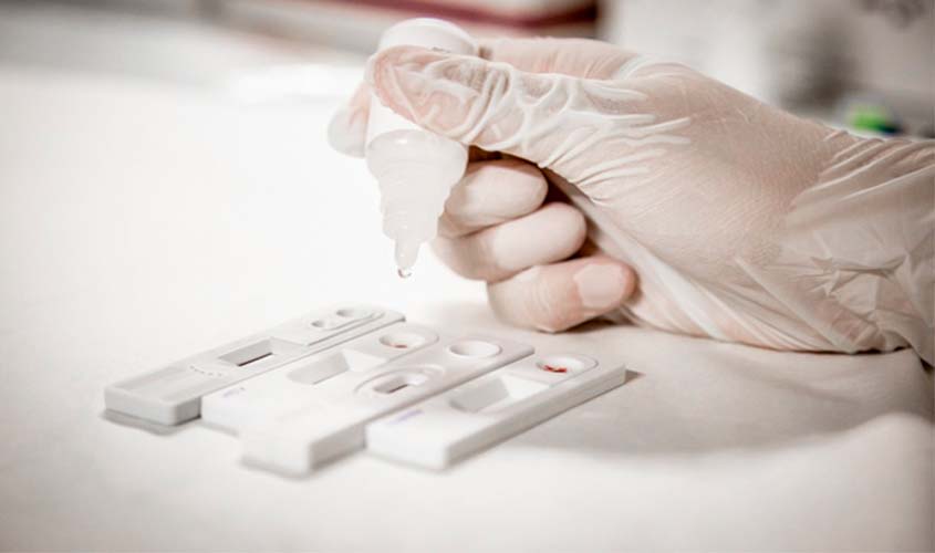 Sexo seguro, com camisinha, previne todas as infecções sexualmente transmissíveis