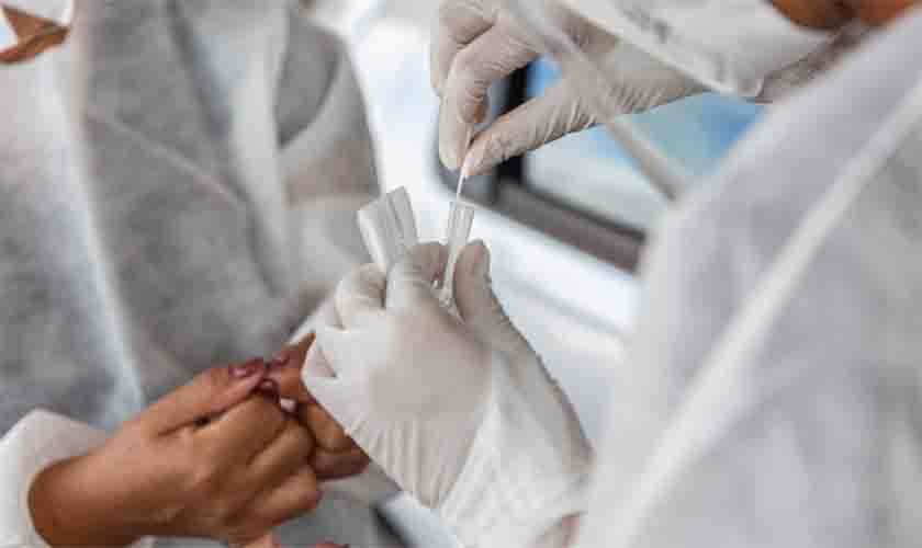 Servidores da Educação serão testados para a Covid-19