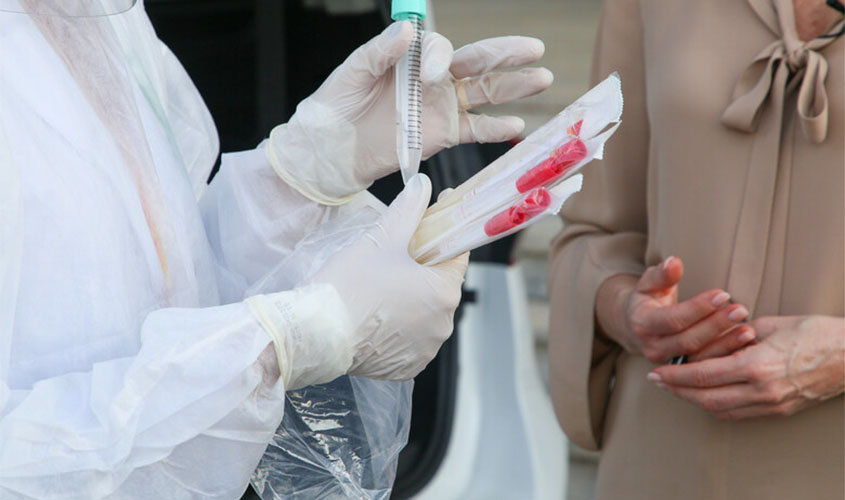 Pico da pandemia no Brasil deve ocorrer em agosto, segundo a OMS