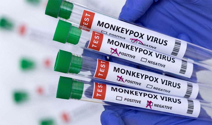 Casos de varíola dos macacos chegam a 76 em todo o país