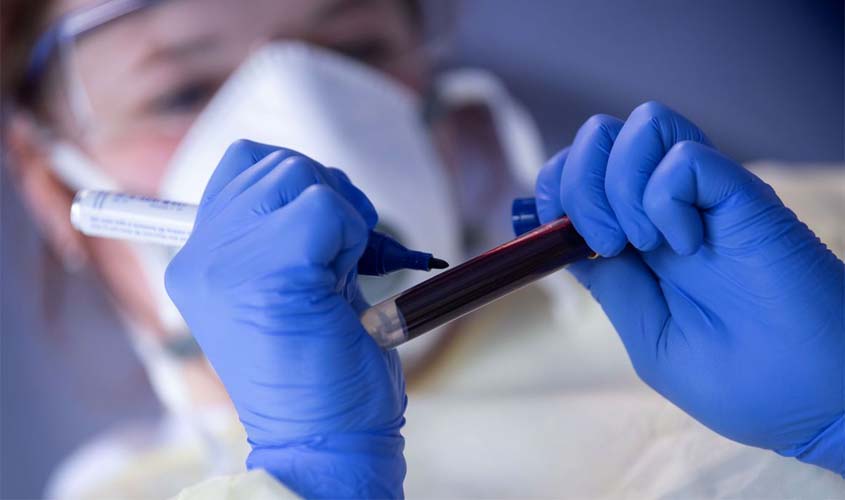 Covid-19: Brasil tem 160 mil mortes e 5,56 milhões de casos acumulados