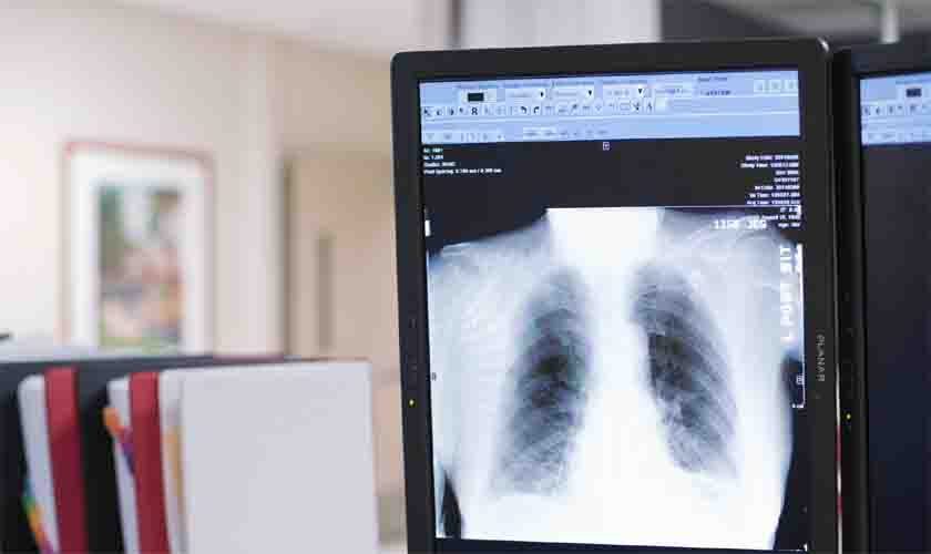 Indenização a ser paga por mineradora a filhos de vítima de silicose é majorada