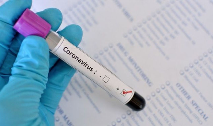 Três servidores da IDARON testam positivo para Coronavírus