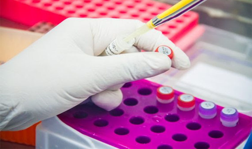 Com um óbito para cada 48 pessoas positivas à Covid-19, autoridades em saúde pedem cautela à população no feriado