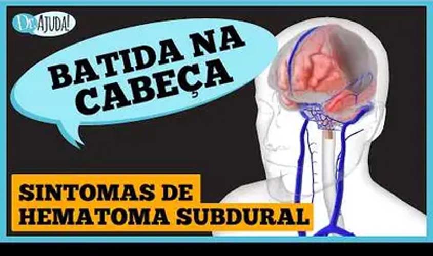 Batida na cabeça: sintomas de hemorragia subdural