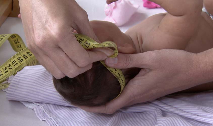 Senado aprova ampliação de pensão a crianças afetadas pelo vírus zika