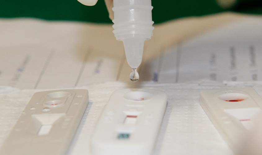 Saiba os riscos causados pelo vírus HIV