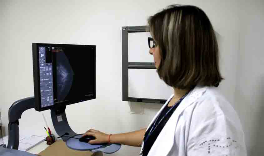 Entidades médicas pedem faixa etária maior para mamografia de rastreio
