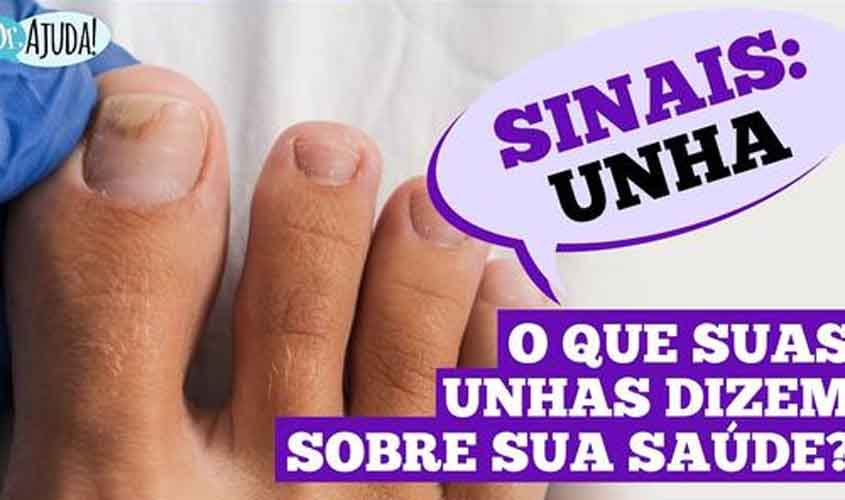 Dr. Ajuda: Unhas fracas podem indicar problemas de saúde