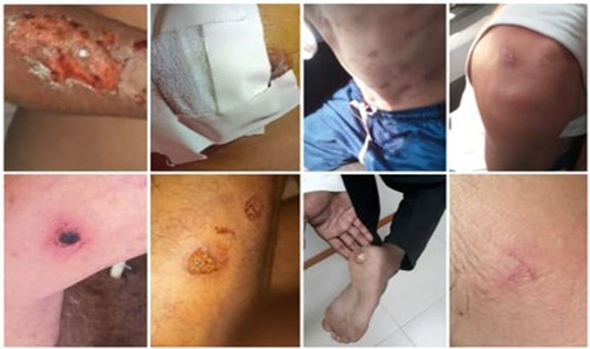 Justiça designa audiência sobre pedido do MPF para apuração de denúncias de tortura em presídio