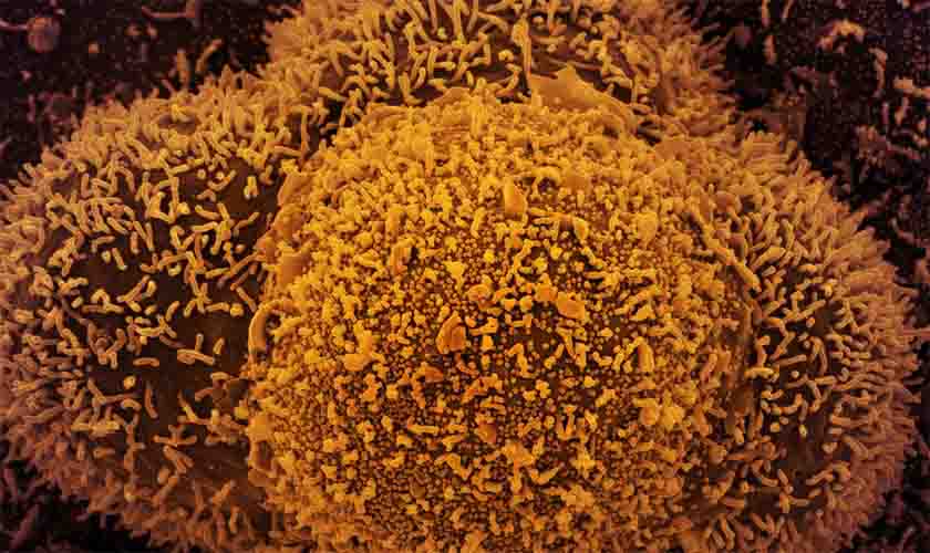 Ministério registra 619,6 mil mortes e 22,38 milhões de casos de covid