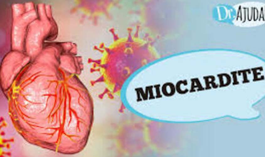 O que é miocardite e quais são os sintomas?