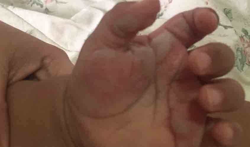 No dia Nacional da Luta Contra Queimaduras, Corpo de Bombeiros alerta sobre acidentes domésticos com crianças