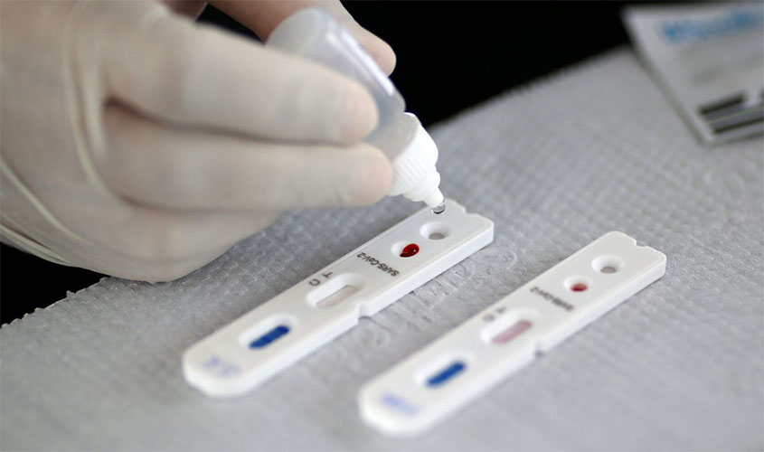 Vacina de Oxford contra covid-19 só será disponibilizada em 2021