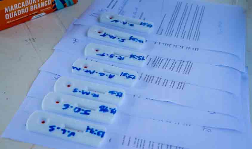 Governo de Rondônia reforça parceria com prefeituras para enfrentamento à pandemia