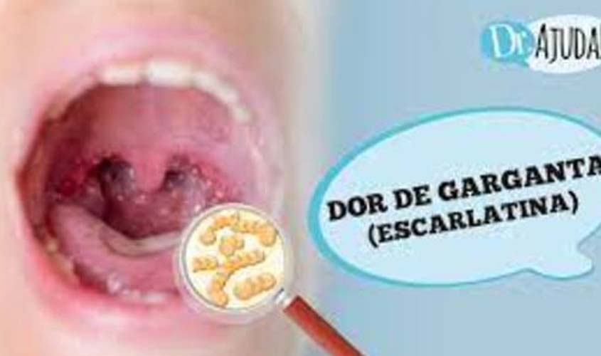 Escarlatina: quais os sintomas, causas e tratamentos