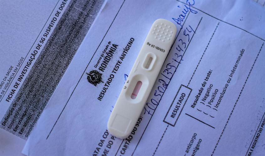 Relatório covid-19 deixará de ser diário e passará a ser semanal