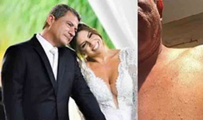 Dias antes de morrer, Tom Veiga relatou agressão por ex-mulher: “estou a base de calmantes”