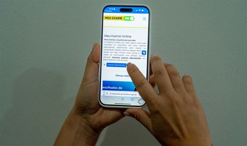 Meu Exame ON supera 6 milhões de exames em Porto Velho