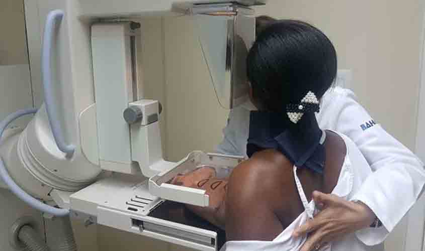 Câmara aprova Moção de Apelo para instalação de aparelho de mamografia para atender mulheres da região