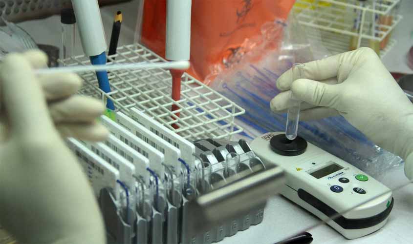 Sesau implanta exame para detecção do vírus da gripe no Lacen; resultados que demoravam 30 dias saem em uma semana