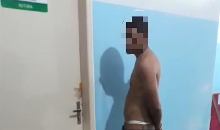 Acusado de tentativa de roubo leva terçadada no rosto