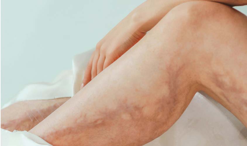 SP recebe encontro sobre doença que mata 100 mil por ano