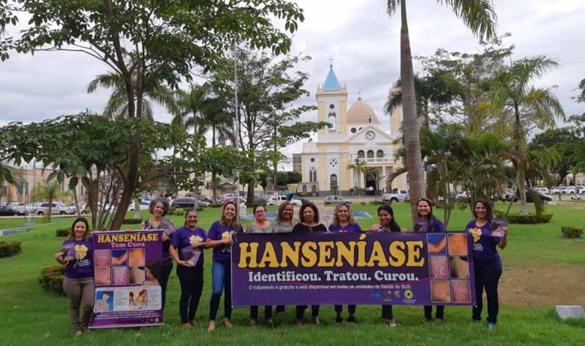 Semusa alerta população sobre os cuidados com hanseníase