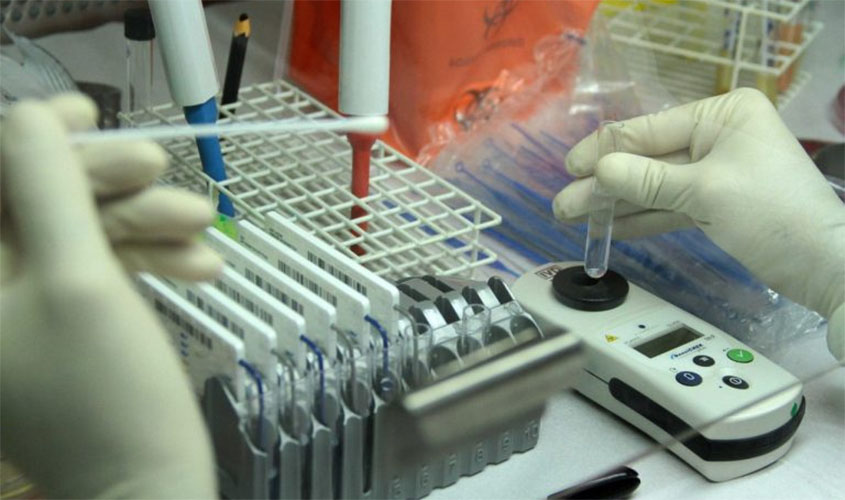 Estado de Rondônia registra 56% de pessoas recuperadas da Covid-19