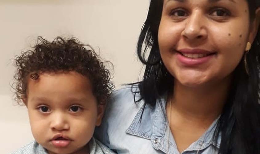 Crianças com lábios leporinos contam com atendimento especial