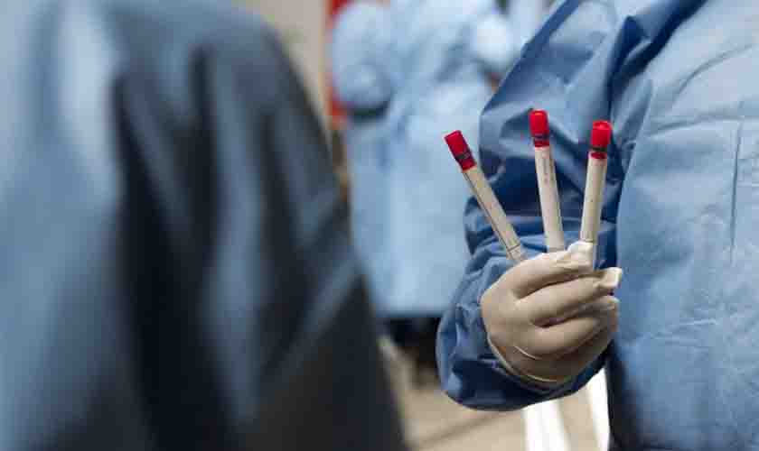 Rondônia registra sete casos da variante delta em seis municípios do estado