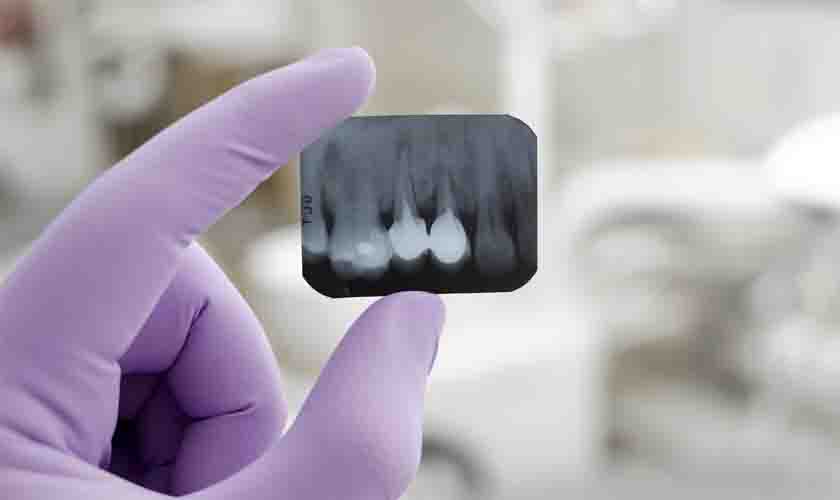 Município pagará adicional de periculosidade a cirurgião dentista por uso de raio X móvel 
