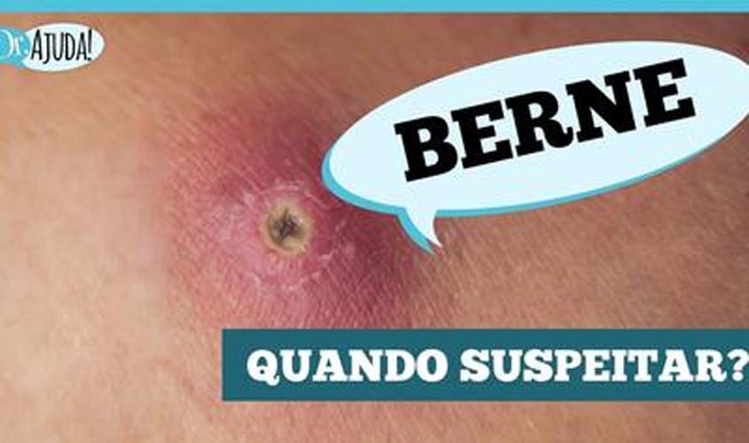Berne: parece espinha, mas é larva sob a pele