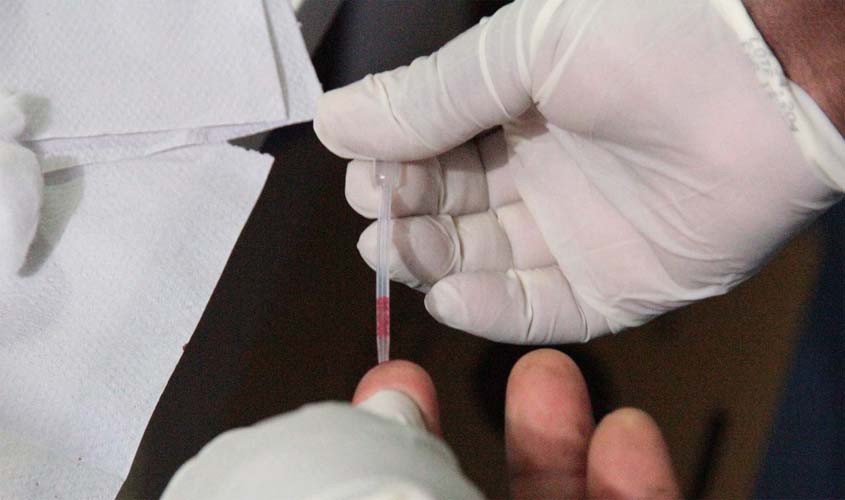 Governo de Rondônia sanciona lei que torna o prazo do laudo de diabetes tipo 1 indeterminado