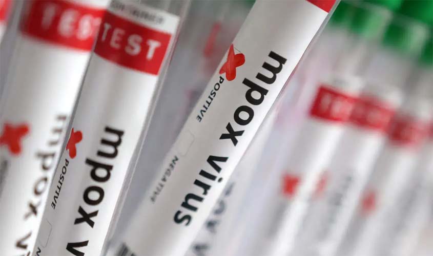 Casos de mpox sobem para 140 no Brasil em 2026