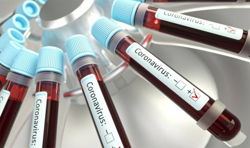 23 casos de COVID-19 em Porto Velho e 02 óbitos