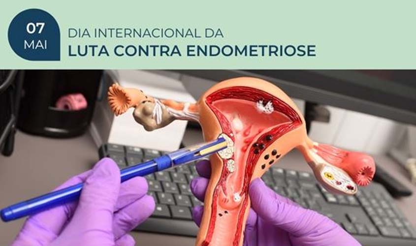A Importância Da Atenção Individualizada À Mulher No Manejo Da Endometriose