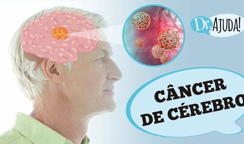 Câncer no cérebro: sintomas, diagnóstico e tratamento