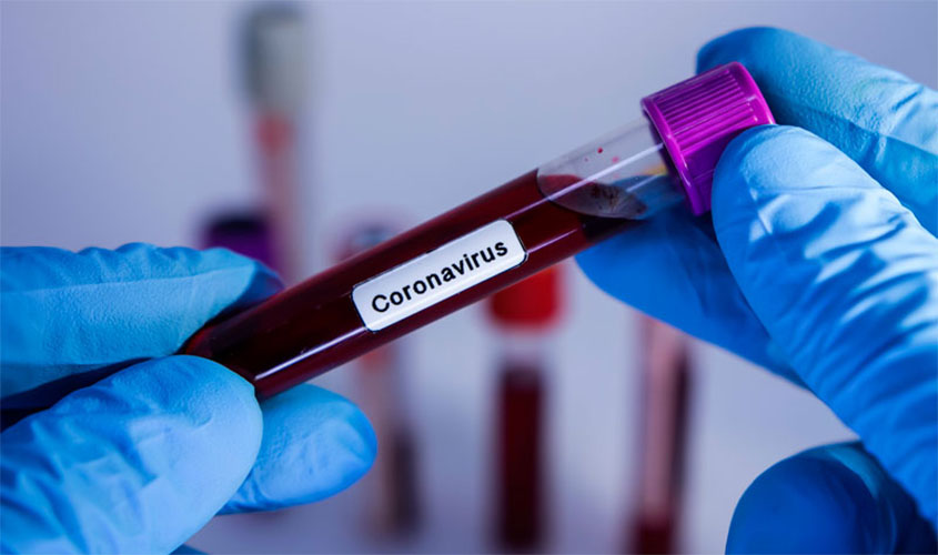 Covid-19 faz 52,5% dos brasileiros terem mais cuidado com a veracidade das notícias