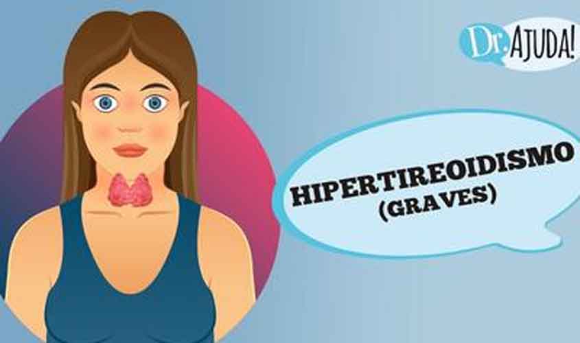 Hipertireoidismo, o que é?