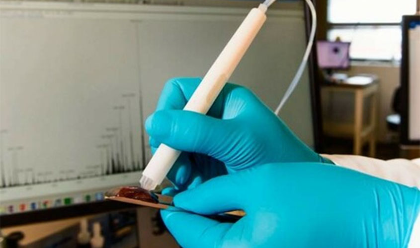 Tecnologia que usa 'caneta' para diagnosticar câncer vai ser usada no combate ao Covid-19