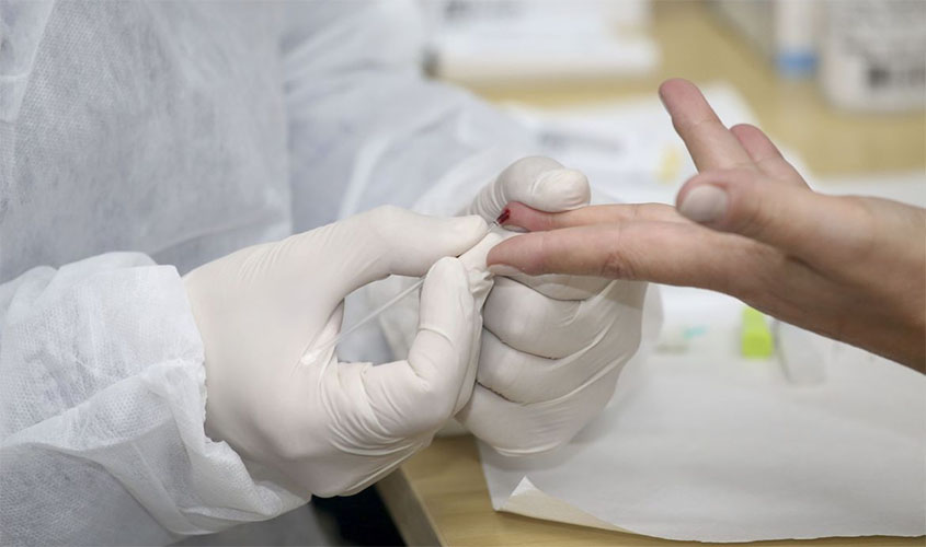 Covid-19: Brasil tem 128,5 mil mortes e 4,19 milhões de casos